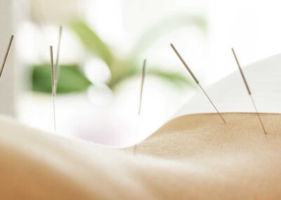 Agopuntura e malattie della pelle